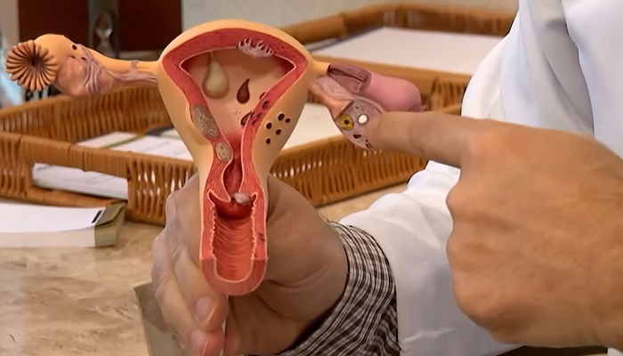 Julho Verde-Escuro conscientiza sobre prevenção ao câncer ginecológico