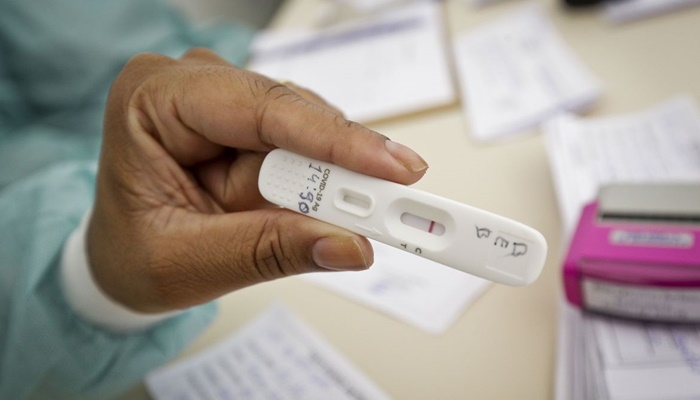 Positividade de testes de covid-19 subiu de 4% para 13%, diz UFRJ