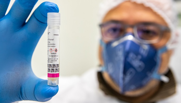  Em 6 meses Lacen processa 13.298 amostras de vírus respiratórios