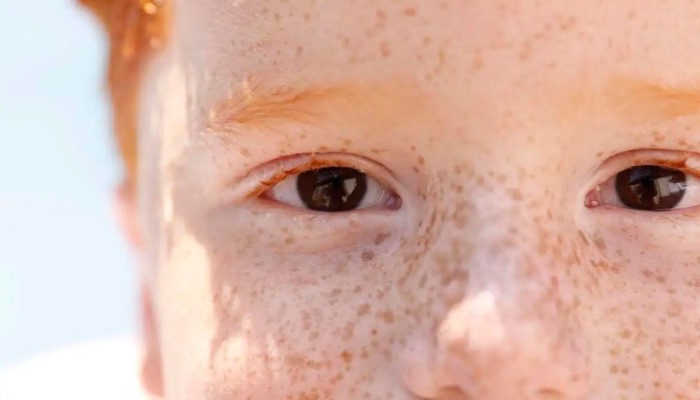 Campanha de conscientização sobre retinoblastoma começa hoje