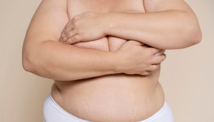 Imagem do Freepik Campanha pede inclusão de medicamentos para obesidade no SUS