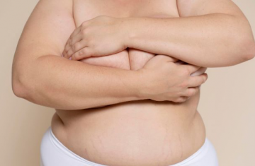  Campanha pede inclusão de medicamentos para obesidade no SUS 