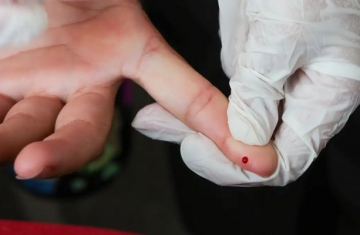 Brasil atinge meta de redução da transmissão vertical de hepatite B