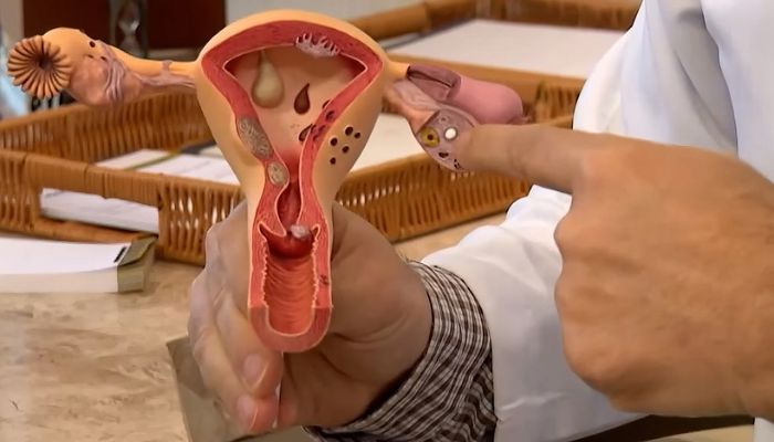 © Frame/TV Brasil Aberta chamada pública para pesquisas sobre endometriose