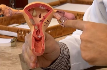 Aberta chamada pública para pesquisas sobre endometriose