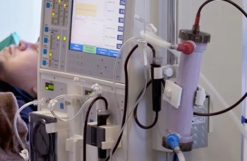 Estudo alerta para subdiagnóstico da doença renal crônica no Brasil