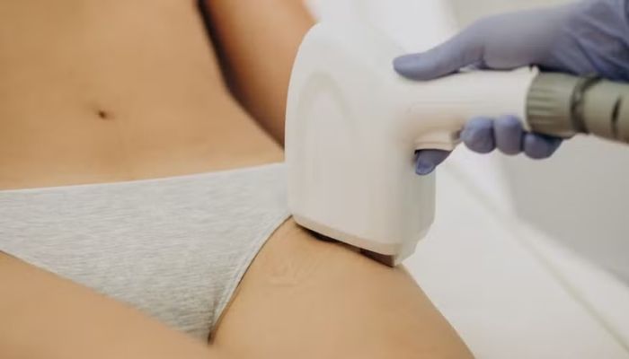 Laser íntimo: saiba por que mulheres têm recorrido ao procedimento