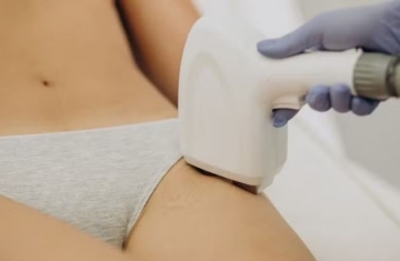 Laser íntimo: saiba por que mulheres têm recorrido ao procedimento